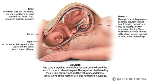 Childbirth expulsion