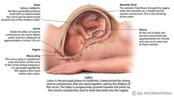 Childbirth labor