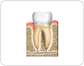 cross section of a molar