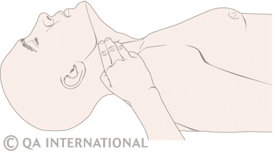 Carotidien pulse