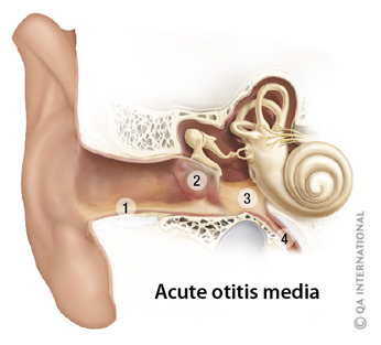 Ear schema