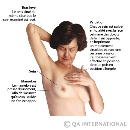 L'autoexamen des seins